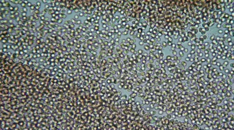 Drop of my blood under microscope Video stock 33661605