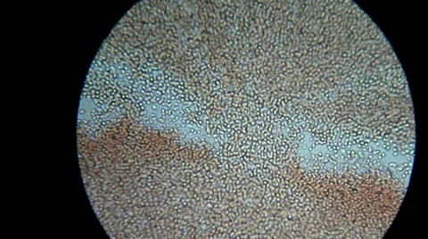 A drop of my blood under microscope Video stock 33661752