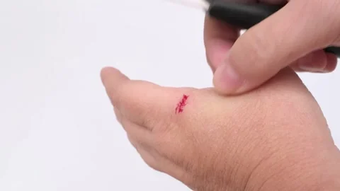 Cut Blood Hurt Stock Video Footage