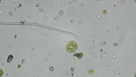 A drop of water from a dirty pond under a microscope, with a multitude of Stock Footage 90827851