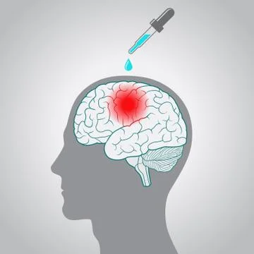 Drops from the dropper to the brain, the concept of a direct treatment Stock Illustration