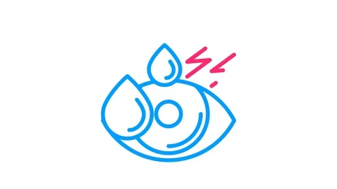 Drops falling in eye from dryness. Body ache. Animated thin line icon Stock Footage 99137070