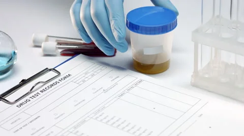 Drug test report Vídeo Stock 68564293