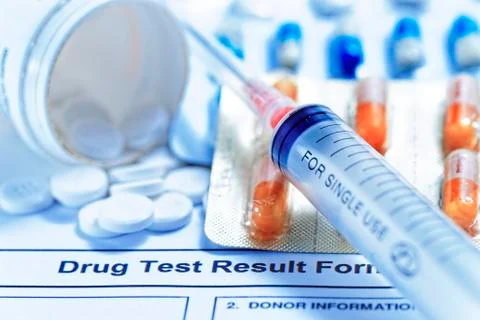 Drug test report Foto stock