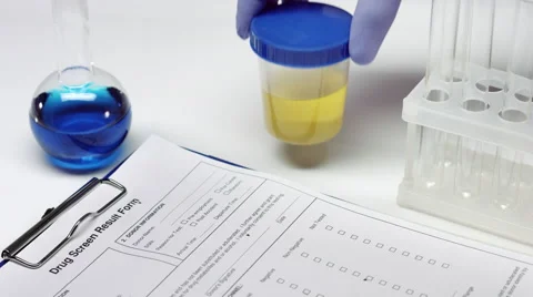 Drug testing Stock Footage 68857447