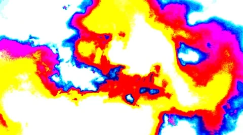 Drug Timelapse  Stock Footage 62292454