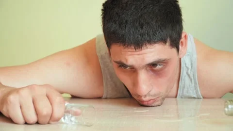 Drunkard guy bruised eye drinks alcoholic drink at home. alcohol addiction Stock Footage 130963119