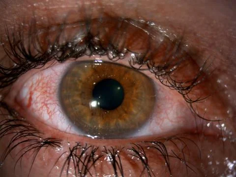 Dry eye Stock Photos