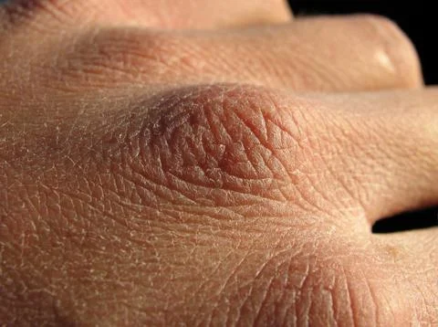 Dry hand Stock Photos