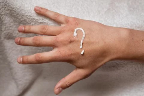 Dry hands with wounds. A question mark is painted on the hands with cream. Stock Photos