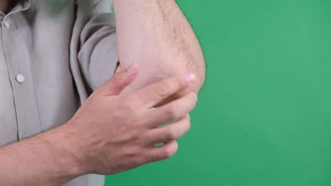 Dry skin applying cream Stock Footage 278306830