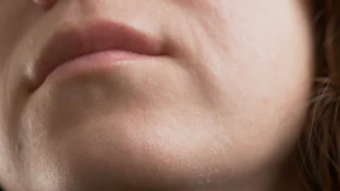 Dry skin closeup face Stock Footage