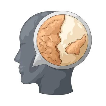 Dry skin illustration Stock Illustration