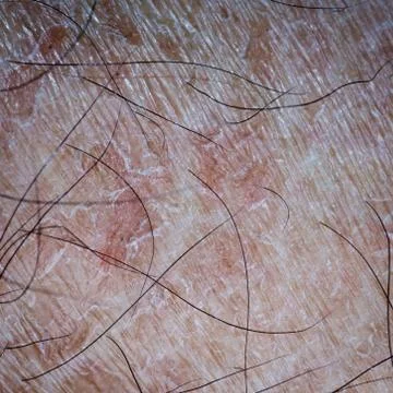 Dry skin texture Foto stock
