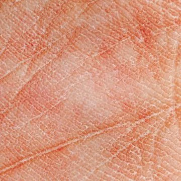 Dry skin texture Stock-Fotos