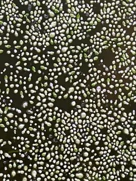 Duckweed Pond Surface Macro Texture Natural Aquatic Background Stock Photos