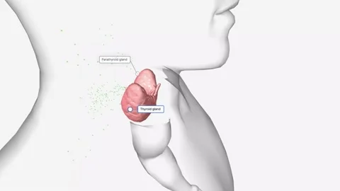 Due to their increased number of cells, enlarged parathyroid glands produce more Stock Footage 231402228