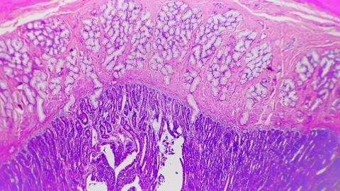 Duodenum of the human being in section s... | Stock Video | Pond5