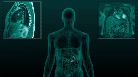 Duodenum MRI Video stock 262866440