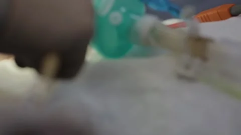 During surgery Stock Footage 154586293