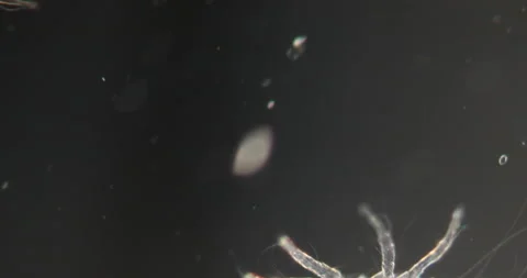 Dust mites in Darkfield Stock Footage 146757491