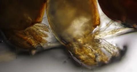 Dust mites seen under a microscope Video stock 314746579