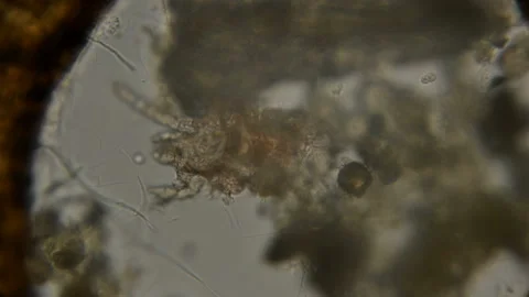 Dust, water mite under a microscope Stock-Footage 89494998