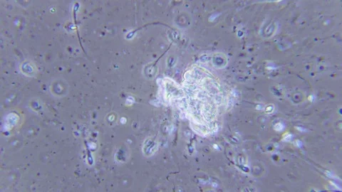 Dying human sperms under Bright field Microscope Video stock 80262278