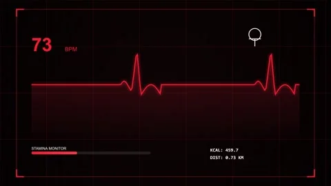 Dynamic ECG rhythm visualization for heart rate monitoring technology interfa Stock Footage 344641962