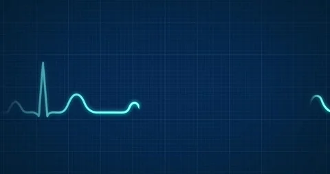 Dynamic electrocardiogram ECG waveform on dark blue medical monitor screen with  Video stock 301997461