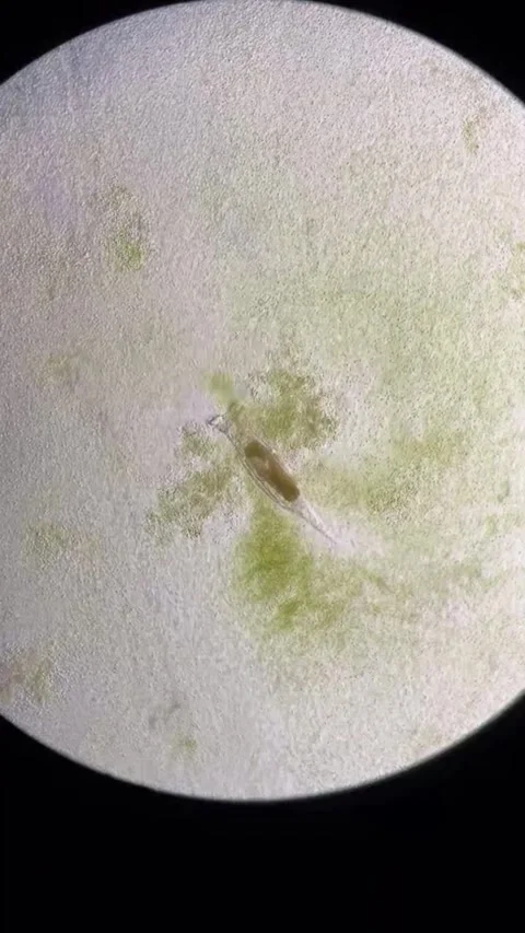 Dynamic Microorganisms Observed Under Microscope in a China Laboratory Stock Footage 338209616