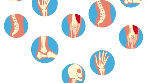 Dynamic motion graphic featuring various human skeletal and joint diagrams,.. Stock Footage 338423615