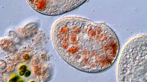 Dynamic Movement of Ciliate Protozoa in Liquid Medium Video stock 318946282