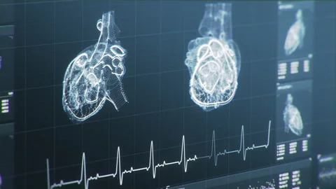 Dynamic pulsating heart. Heart beat line. Cardiogram signal monitoring process Stock-Footage 158981522