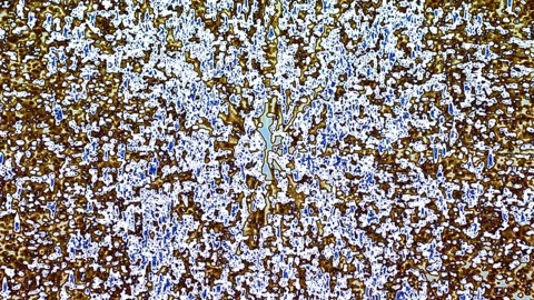 Dynamic Speckled Patterns in Motion Hypnotic Swirling Textures Animation Stock Footage 302684358