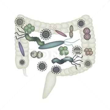 Dysbacteriosis of the intestine. Colon. dysbiosis of colon. Bacteria ...