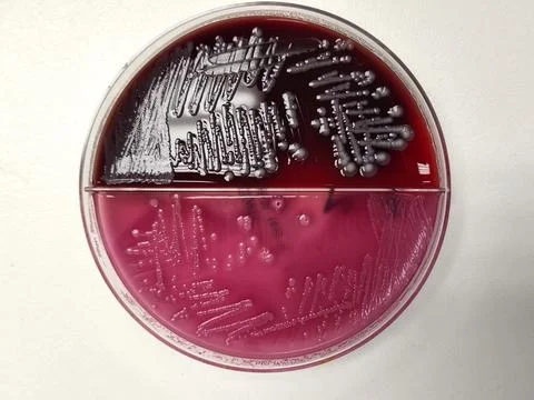 E. coli bacteria growing on blood and Macconkey agar Stock Photos