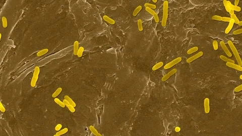 E coli on the human skin surface, SEM Stock Footage 79704972