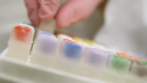 E-coli vials Stock Footage 86821463