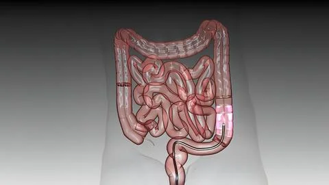 Eamination of the large intestine under amonitor with a fiberoptic camera by  Stock Illustration