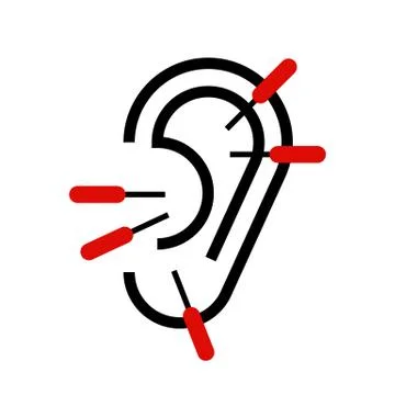 Ear acupuncture Illustrazione stock