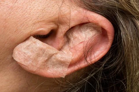 Ear Acupunture Stock Photos