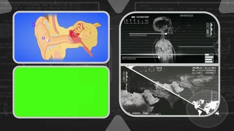 Ear - Analysis in software - examination - background grey 02 Video stock 62463447