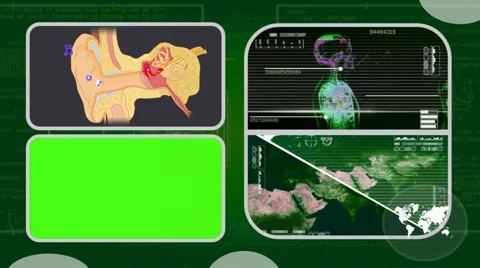 Ear - Analysis in software - examination - background green 03 Video stock 62463460
