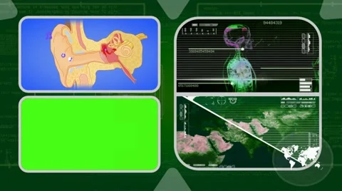 Ear - Analysis in software - examination - background green 02 Video stock 62463461