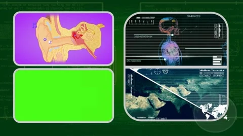 Ear - Analysis in software - examination - background green 01 Video stock 62463463