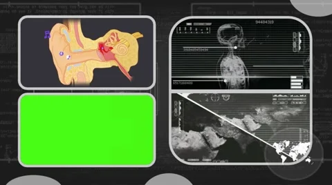 Ear - Analysis in software - examination - background grey 03 Video stock 62463507