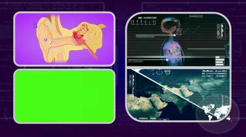 Ear - Analysis in software - examination - background purple 01 Video stock 62463524