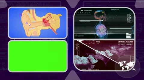 Ear - Analysis in software - examination - background purple 02 Video stock 62463532