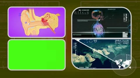 Ear - Analysis in software - examination - background yellow 01 Video stock 62463640